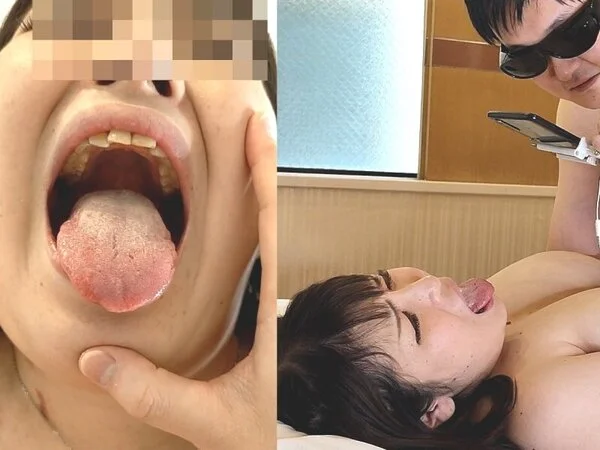 激クサ黄色の汚舌!! 歯医者変態プレイ!!大口を開けさせ、口腔内を楽しみ、鼻舐め