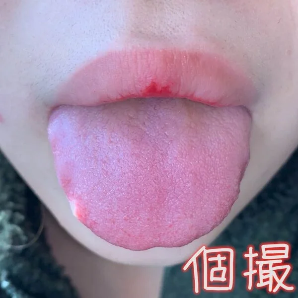 【個人撮影】(※注)巨根女(喉ちんこ)の口内を観察してみたら虫歯・ヤニ・巨大喉ち