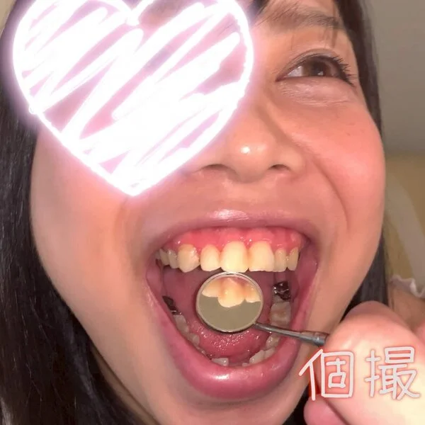 【個人撮影】『※デブ専』樽娘の銀歯多めな歯強度チェック こころ【Y-158】