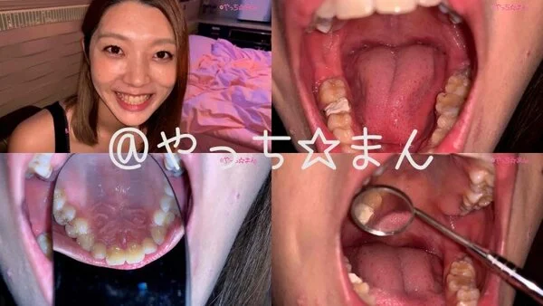 【個人撮影】実はエッチな近所のお姉さんの歯観察 香苗レノン【Y-221】