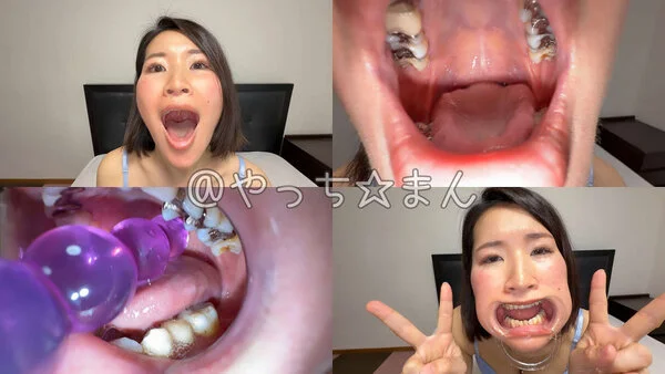 【口内観察】宮下まどかの喉チン触り&開口器Wピー