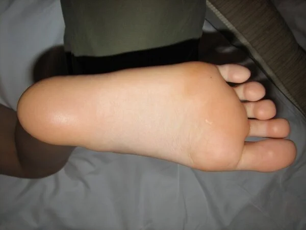 NO.6 18歳専門学生さんの足の裏写真集