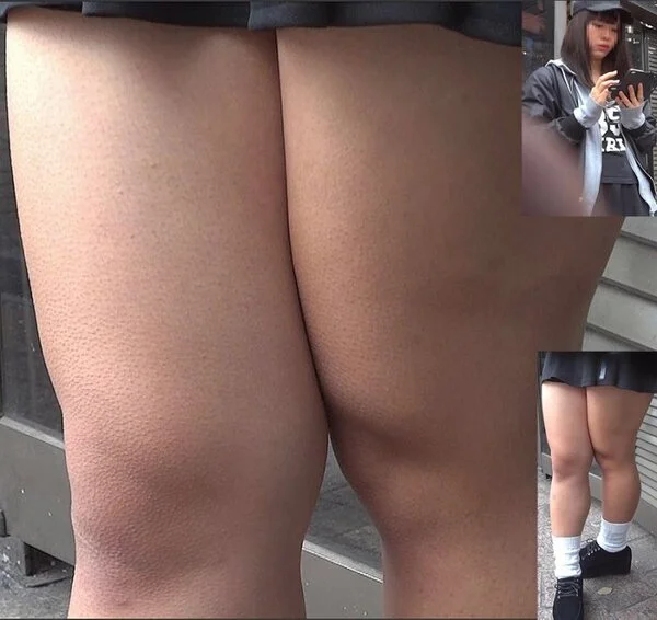 必見!寒いので凄い鳥肌になってます!超ぶっといムチ生足の女の子を接写したよ