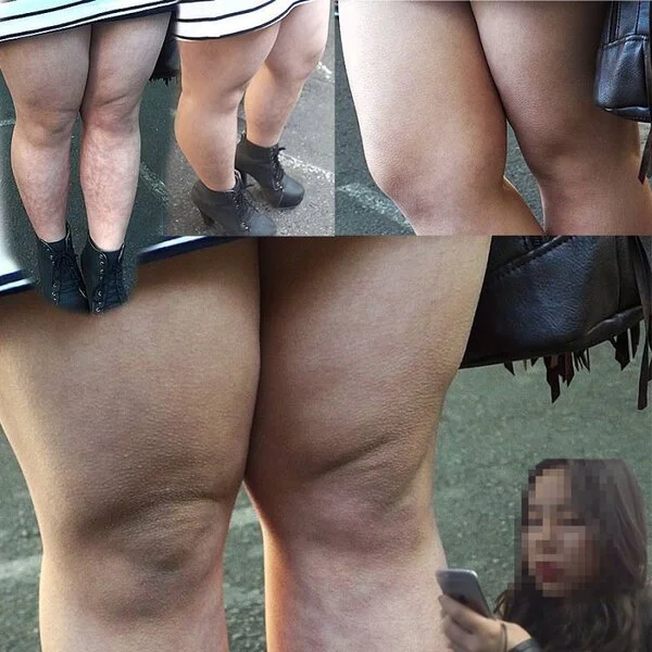ナイスな鳥肌!ボツボツ ムチムチ生足の女の子を接写したよ