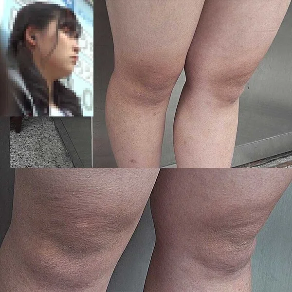 THE 生活感!カッサカサ、ボツボツの生活感のある脚 ムッチムチ生足の女の子を接