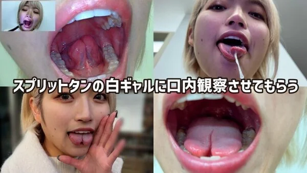 街角で声をかけて口内観察させてもらう 美容部員 はるのちゃん nko05-1