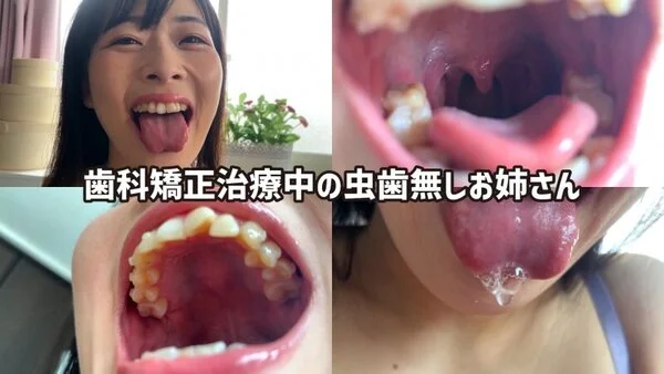 街角で声をかけて口内観察させてもらう ファーストフード店パート みおりさん nk