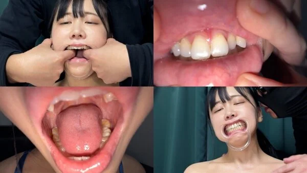 よだれダラダラすずちゃんの口内観察 nko07-1