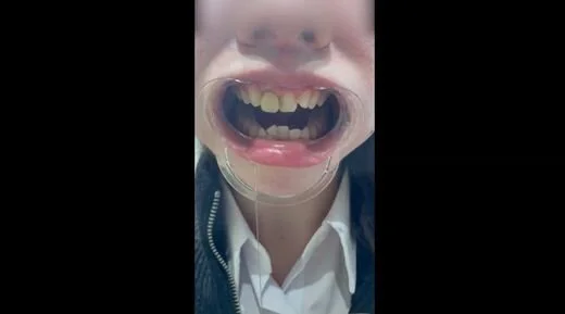 【完全素人・個人撮影】美女人妻を歯科検診余す所なく完全公開。※こちらの商品は再販