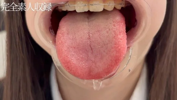 【素人・口腔フェチ】矯正器具+銀歯の身長156cm・18歳。小生意気な態度での初