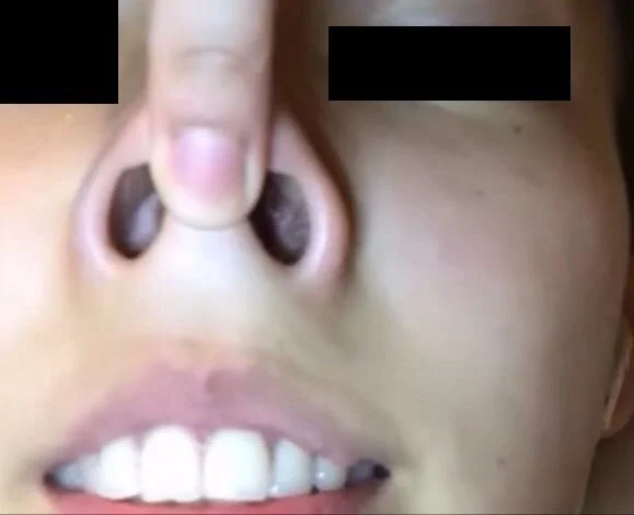 プレミア★ノーズXX 美人半端ないって