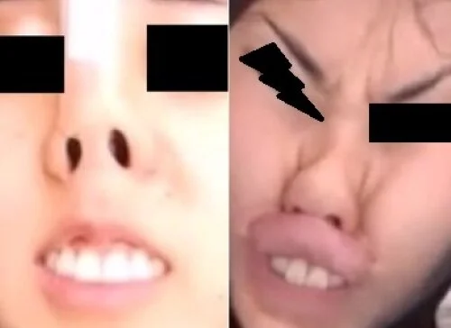 プレミア★ノーズXX 天然美女のブタパンパンチ
