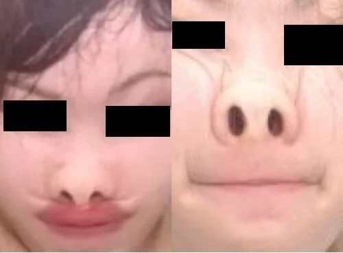 プレミア★ノーズXX 可愛いけど崩しダイッタン
