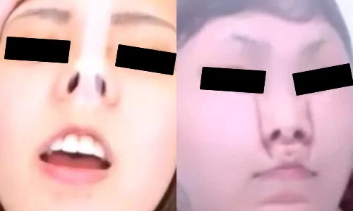 プレミア★ノーズXX 豚鼻を止めるな!