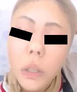 プレミア★ノーズXX 豚鼻ガッツリパンストツリツリ