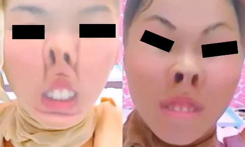 プレミア★ノーズXX 理想の美鼻美顔