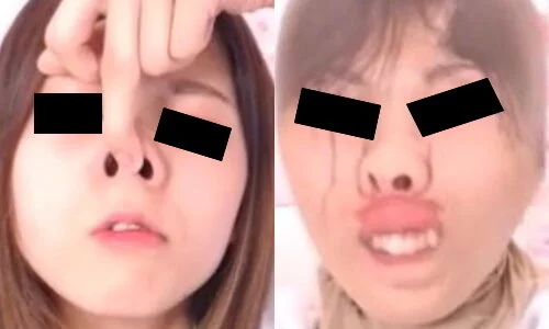 プレミア★ノーズXX 崩れた顔見られたくない
