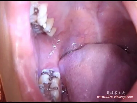 【動画】「あさみ」の口内・超接写観察-part2-[UC13ASAMI02]