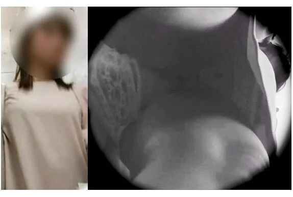 痴ch_42 ～手マン■■は婚活娘のパンティ内でハッスル中～