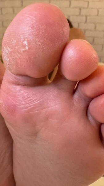 【閲覧注意】内出血×デカ足×ブーツ脱ぎたての足の裏