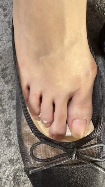 真夏に素足にパンプスで蒸れた足の裏