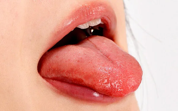Lips 2