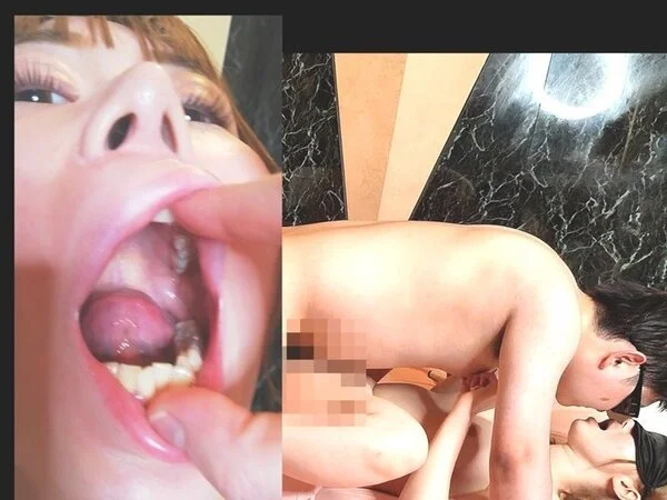 過去作No1の美女ひなちゃんに歯医者変態プレイ!!大口を開けさせ、口腔内を楽しみ