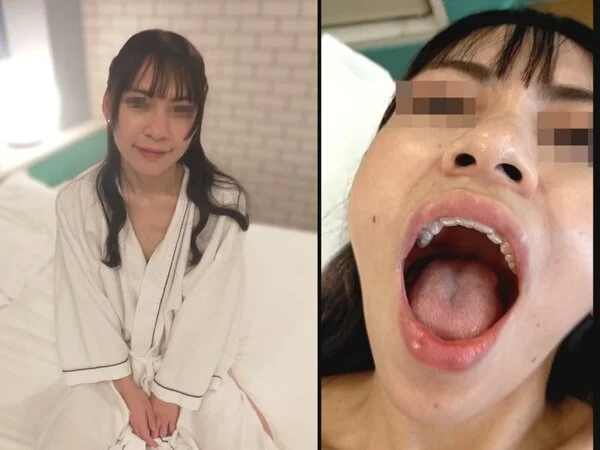 本編顔出し!!【元芸能人のプレミアハーフ美女】しずかちゃんに歯医者変態プレイ!!