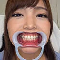 【歯フェチ】碧しのちゃんの歯を観察しました!