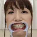 【歯フェチ】加藤あやのさんの歯を観察しました!