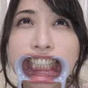 【歯フェチ】晶エリーちゃんの歯を観察しました!