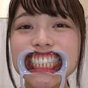 【歯フェチ】宮沢ちはるちゃんの歯を観察しました!