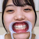 【歯フェチ】水卜麻衣奈ちゃんの歯を観察しました!