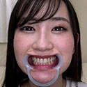 【歯フェチ】神野ひなちゃんの歯を観察しました!
