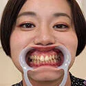 【歯フェチ】平井栞奈さんの歯を観察しました!