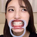 【歯フェチ】森沢かなちゃんの歯を観察しました!