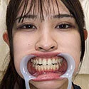 【歯フェチ】盛岡みゆちゃんの歯を観察しました!