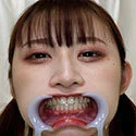 【歯フェチ】水原みそのちゃんの歯を観察しました!