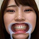 【歯フェチ】竹内夏希ちゃんの歯を観察しました!