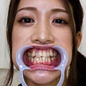 【歯フェチ】有賀みなほさんの歯を観察しました!