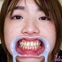 【歯フェチ】花狩まいちゃんの歯を観察しました!