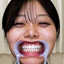 【歯フェチ】如月ゆのちゃんの歯を観察しました!