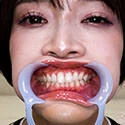【歯フェチ】丹羽すみれちゃんの歯を観察しました!