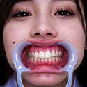 【歯フェチ】有栖舞衣ちゃんの歯を観察しました!