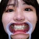 【歯フェチ】日向ひかげちゃんの歯を観察しました!