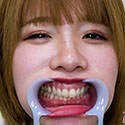 【歯フェチ】二宮ももちゃんの歯を観察しました!