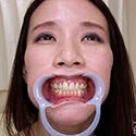 【歯フェチ】伊東沙蘭さんの歯を観察しました!