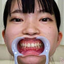 【歯フェチ】伊織ひなのちゃんの歯を観察しました!