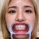 【歯フェチ】氷堂りりあちゃんの歯を観察しました!