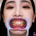【歯フェチ】小松杏ちゃんの歯を観察しました!